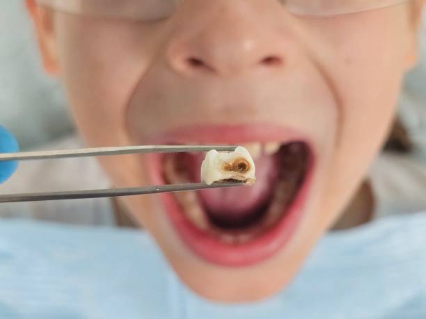 Best Cracked Tooth Emergency Dentist  in Grand Coulee, WA
